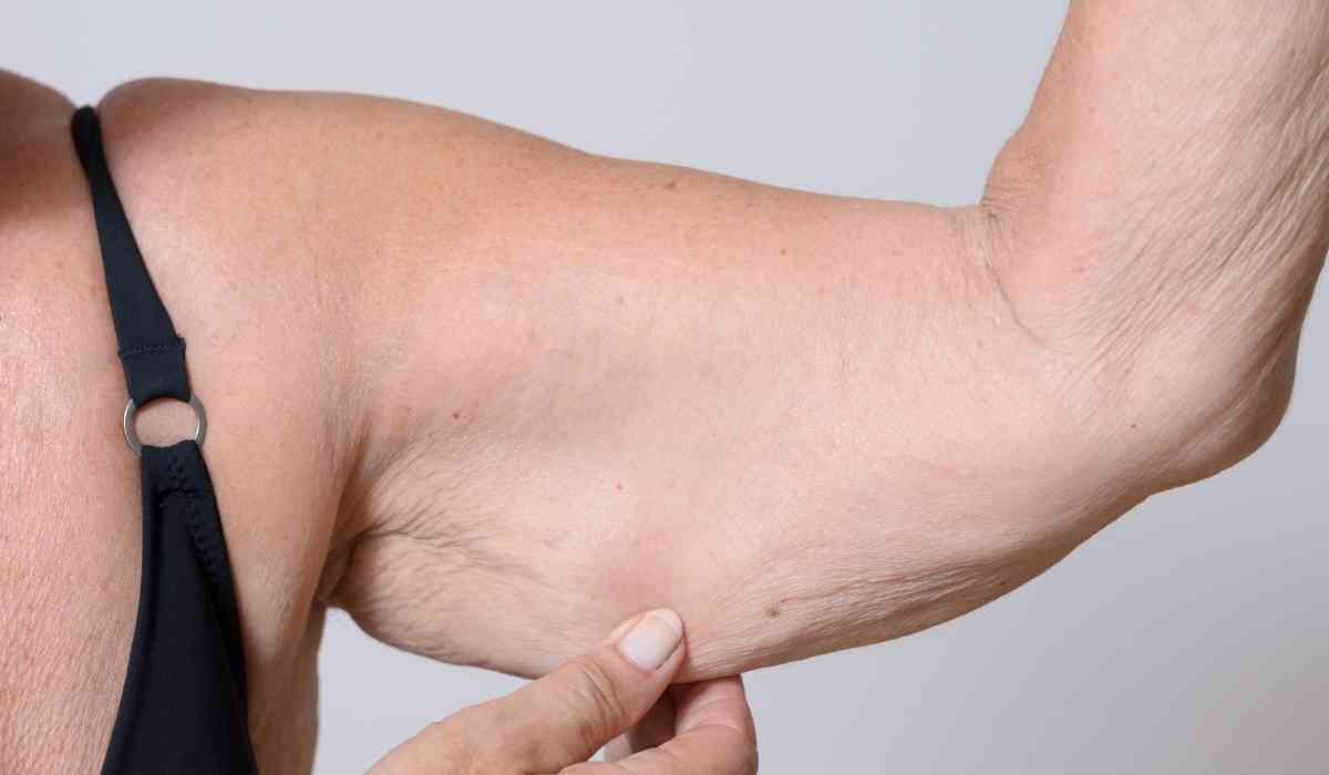 شد-الذراعين-بالخيوط-الجراحية