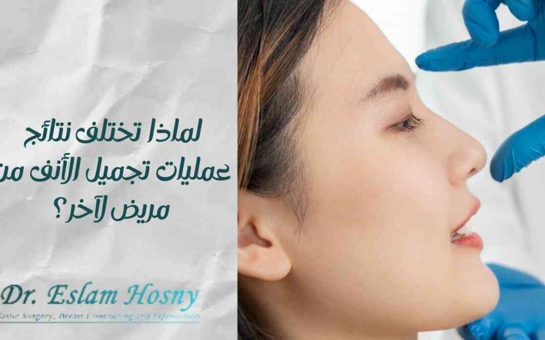 لماذا تختلف نتائج عمليات تجميل الأنف من مريض لآخر؟