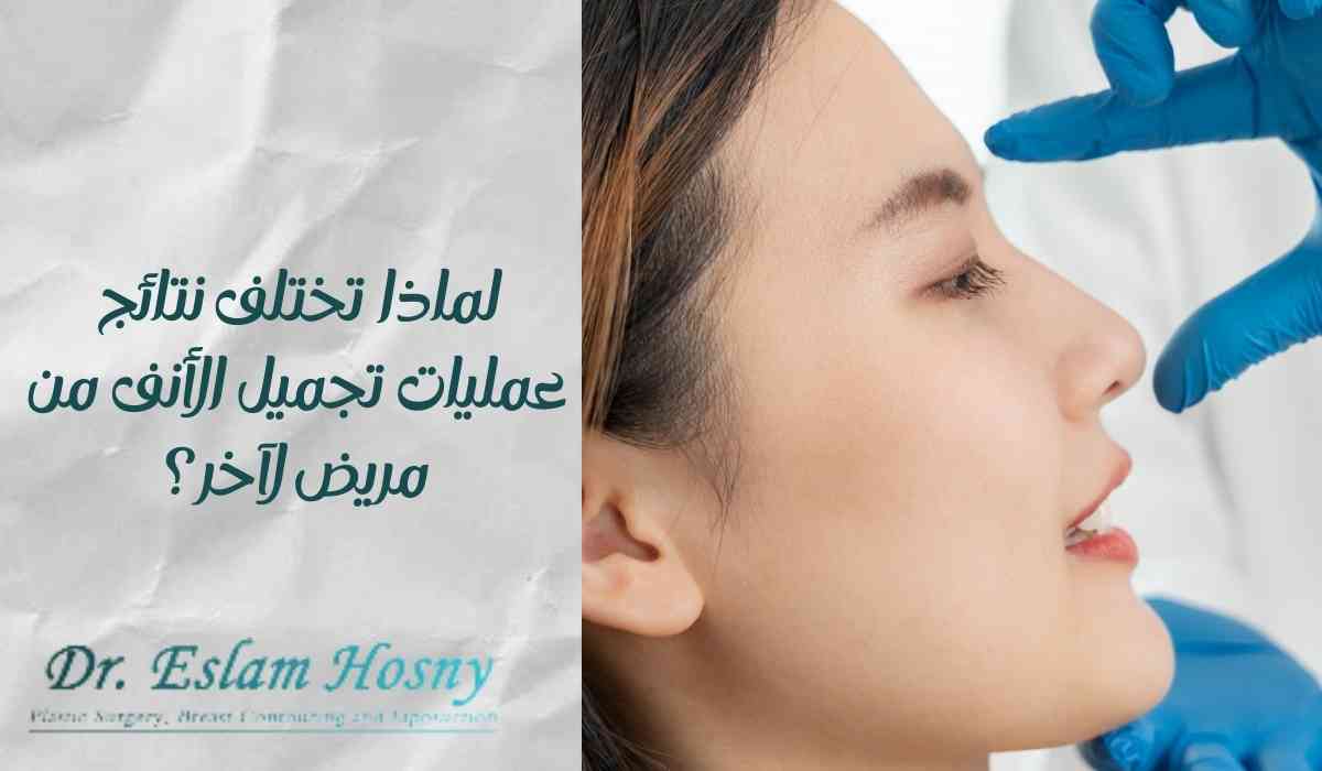 اختلاف-نتائج-عمليات-تجميل-الأنف