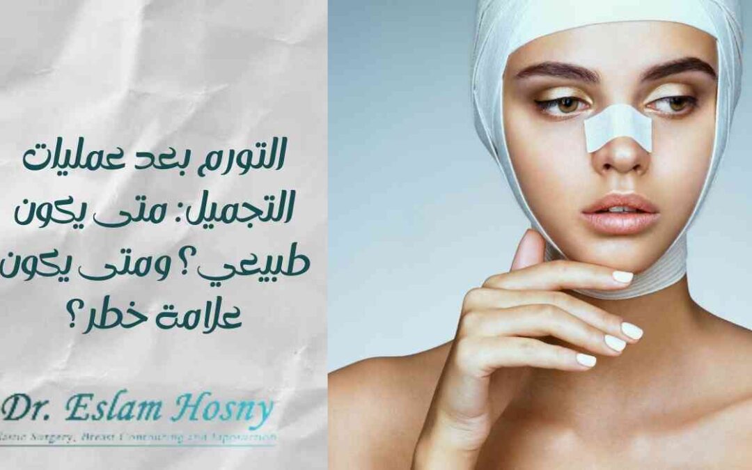 التورم بعد عمليات التجميل: متى يكون طبيعي؟ ومتى يكون علامة خطر؟