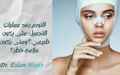 التورم بعد عمليات التجميل: متى يكون طبيعي؟ ومتى يكون علامة خطر؟