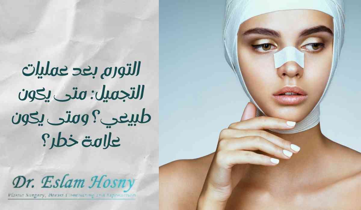 التورم-بعد-عمليات-التجميل