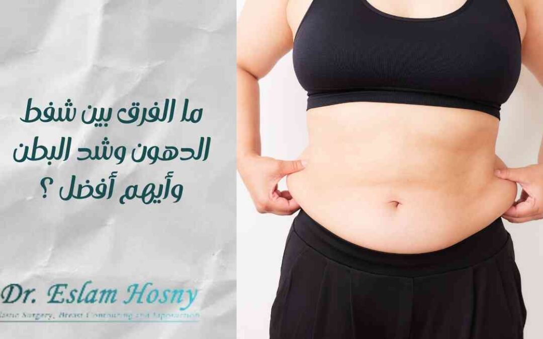 ما الفرق بين شفط الدهون وشد البطن وأيهم أفضل؟