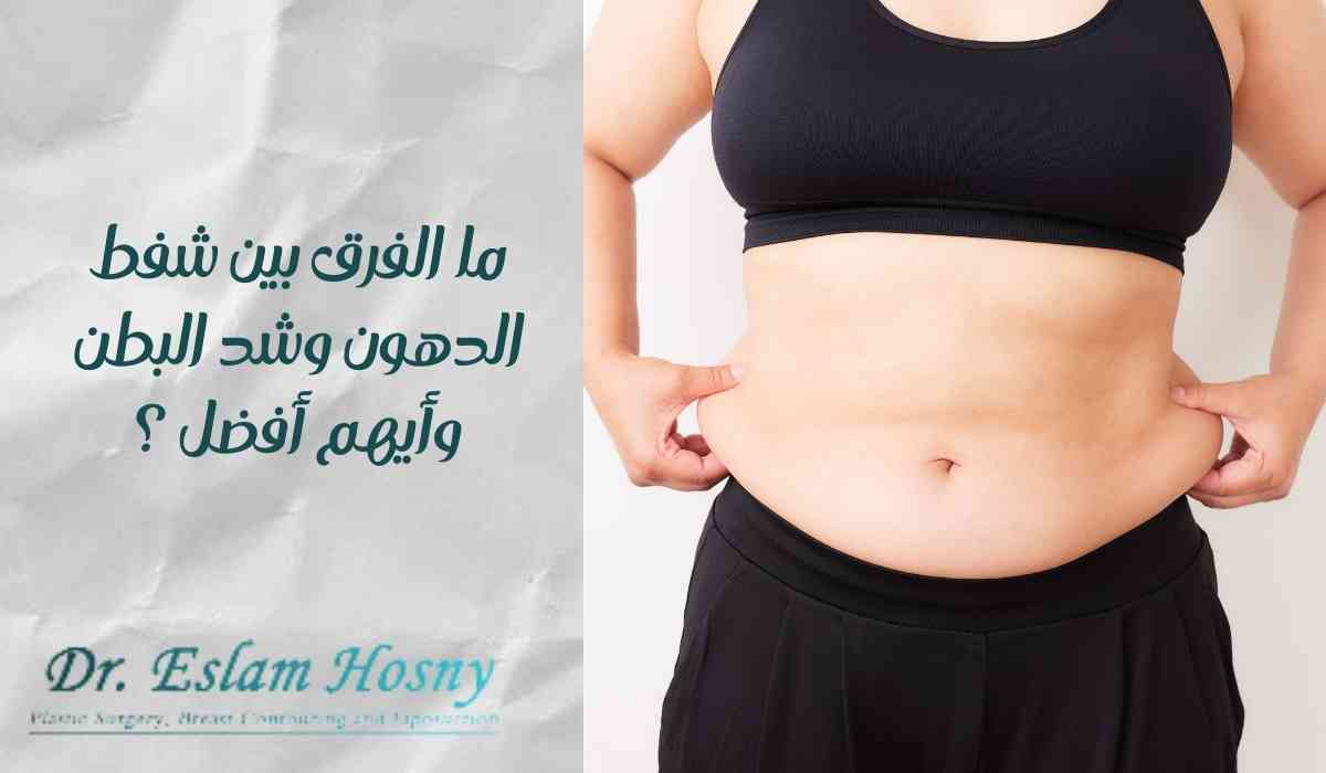 الفرق-بين-شفط-الدهون-وشد-البطن