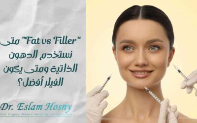 “Fat vs Filler” متى نستخدم الدهون الذاتية ومتى يكون الفيلر أفضل؟