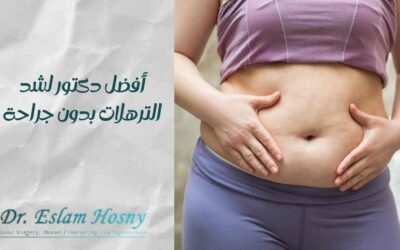 أفضل دكتور لشد الترهلات بدون جراحة