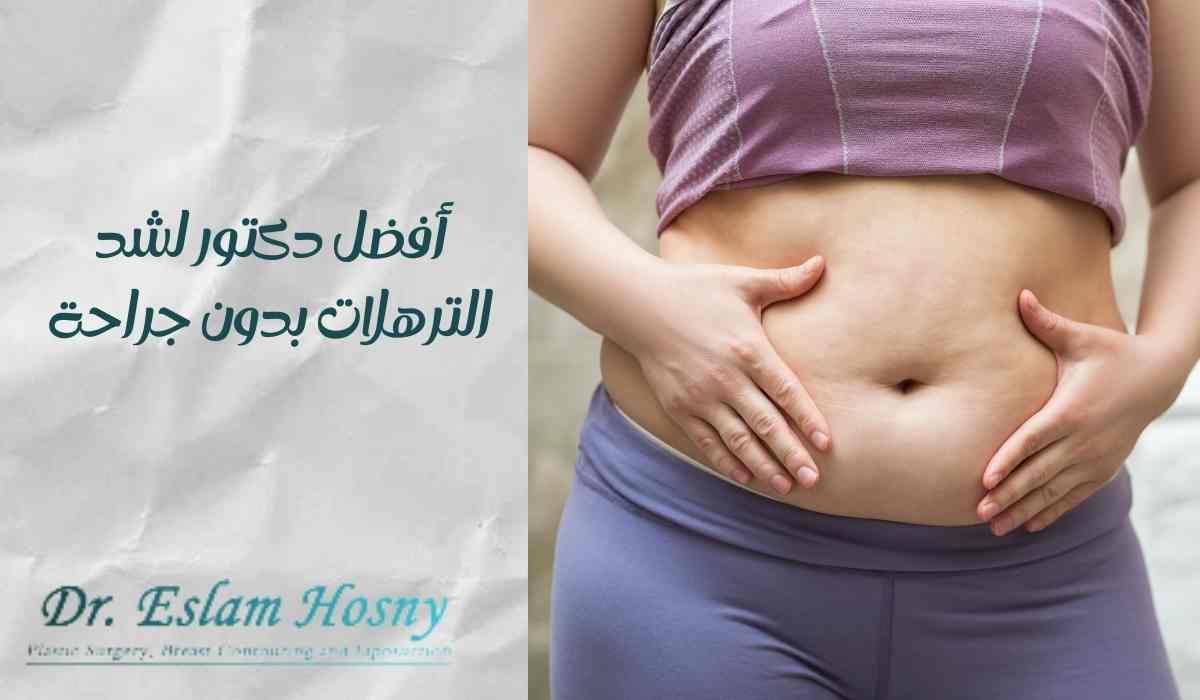 أفضل-دكتور-لشد-الترهلات-بدون-جراحة أفضل-دكتور-لشد-الترهلات-بدون-جراحة