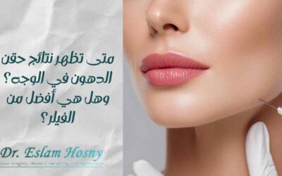 متى تظهر نتائج حقن الدهون في الوجه؟ وهل هي أفضل من الفيلر؟