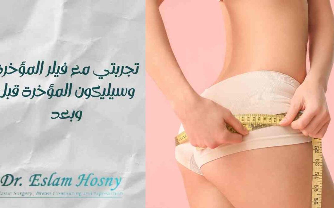 تجربتي مع فيلر المؤخرة وسيليكون المؤخرة قبل وبعد