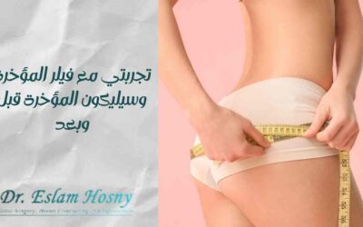 تجربتي مع فيلر المؤخرة وسيليكون المؤخرة قبل وبعد