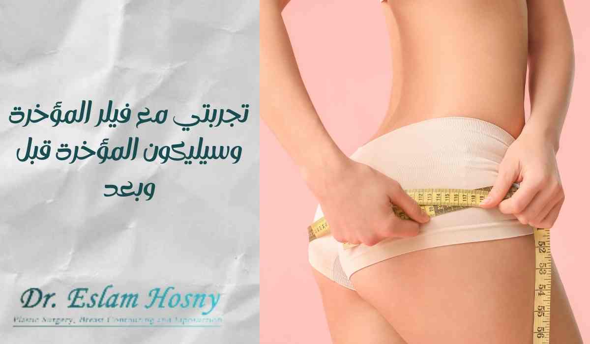 تجربتي-مع-سيليكون-المؤخرة-قبل-وبعد