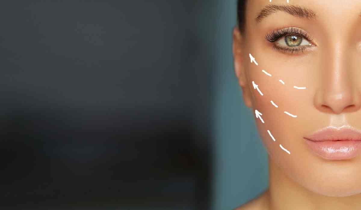 تجربتي-مع-شد-الوجه-بالليزر