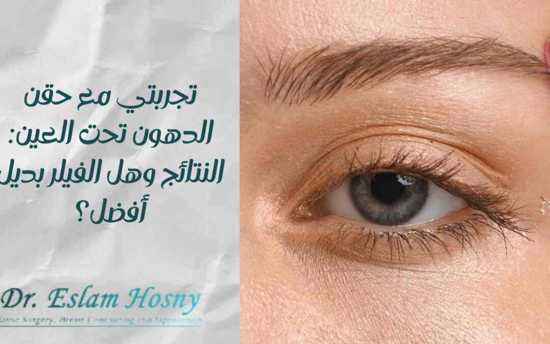 تجربتي مع حقن الدهون تحت العين: النتائج وهل الفيلر بديل أفضل؟