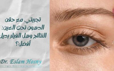 تجربتي مع حقن الدهون تحت العين: النتائج وهل الفيلر بديل أفضل؟