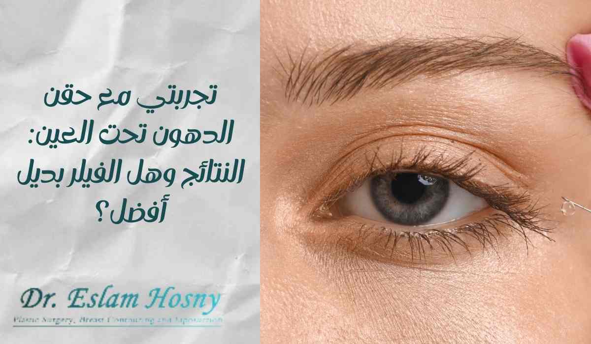 تجربتي-مع-حقن-الدهون-تحت-العين