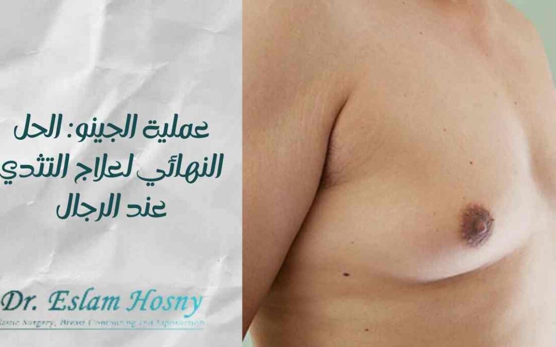 عملية الجينو: الحل النهائي لعلاج التثدي عند الرجال