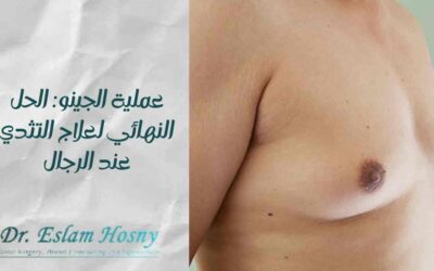 عملية الجينو: الحل النهائي لعلاج التثدي عند الرجال
