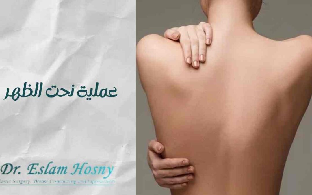 عملية نحت الظهر