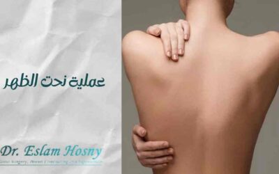 عملية نحت الظهر