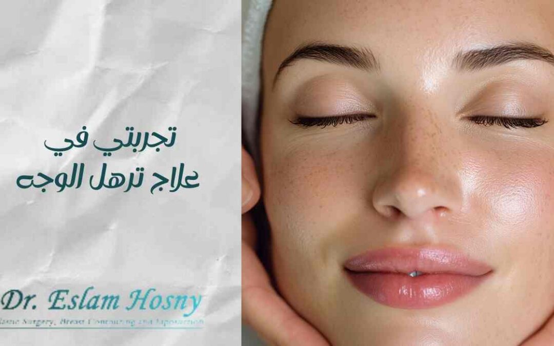 تجربتي في علاج ترهل الوجه