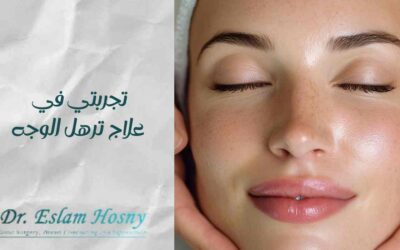 تجربتي في علاج ترهل الوجه