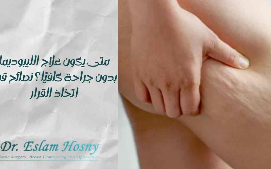 متى يكون علاج الليبوديما بدون جراحة كافيًا؟ نصائح قبل اتخاذ القرار