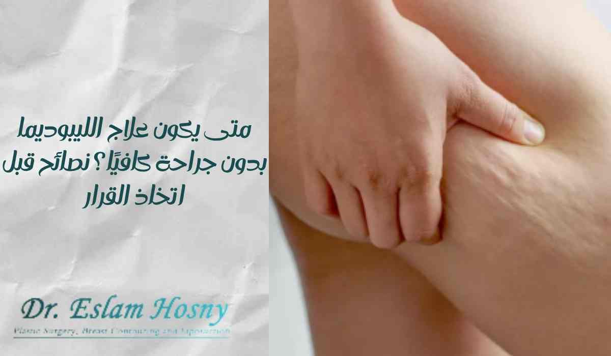 علاج-الليبوديما-بدون-جراحة