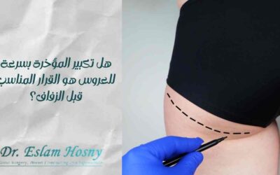 هل تكبير المؤخرة بسرعة للعروس هو القرار المناسب قبل الزفاف؟