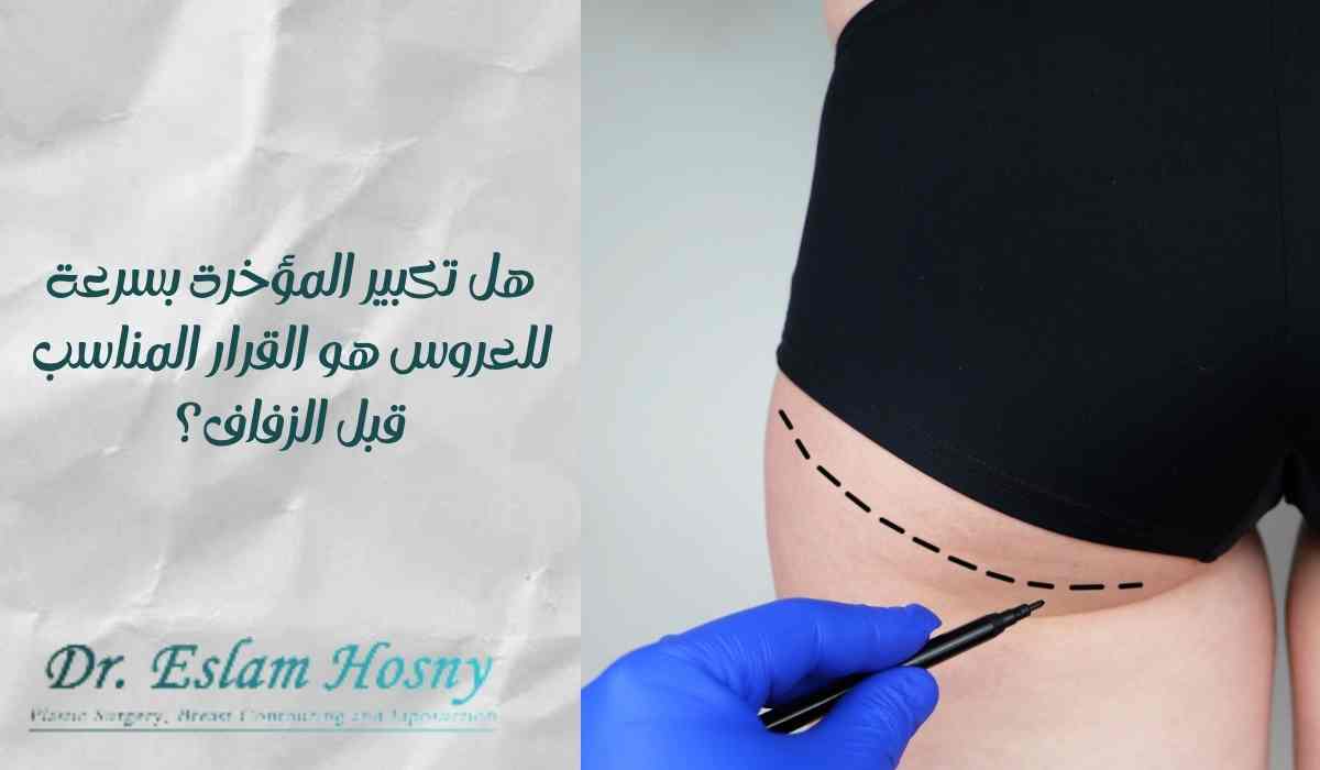 تكبير-المؤخرة-بسرعة-للعروس