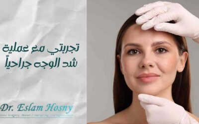 تجربتي مع عملية شد الوجه جراحياً: ما يجب أن تعرفه قبل نصح أي شخص بإجراء العملية