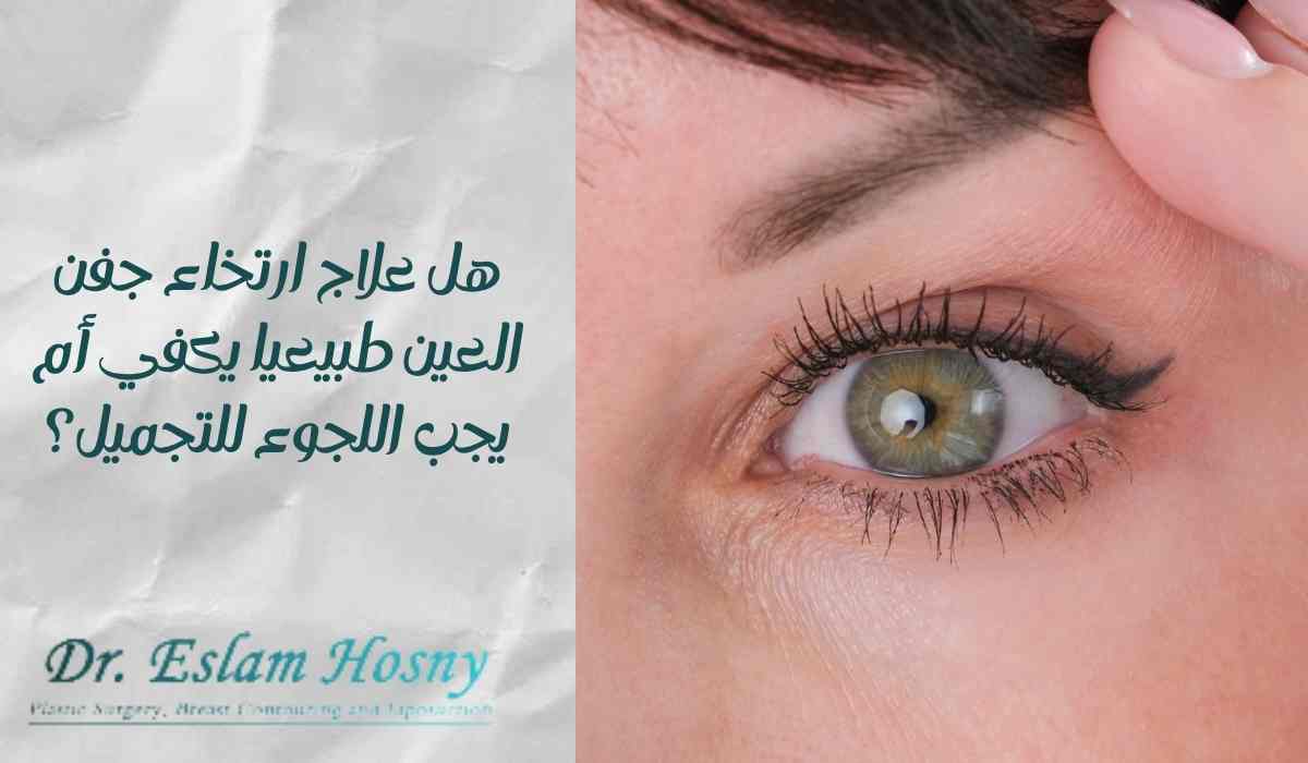 علاج-ارتخاء-جفن-العين-طبيعيا