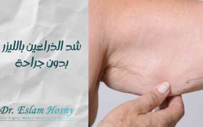 شد الذراعين بالليزر بدون جراحة