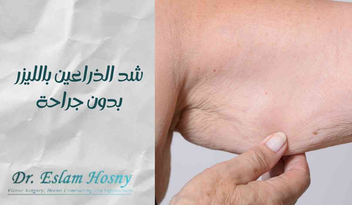شد-الذراعين-بالليزر-بدون-جراحة