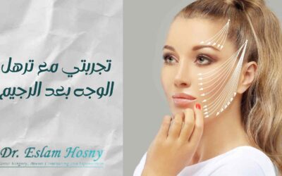 تجربتي مع ترهل الوجه بعد الرجيم
