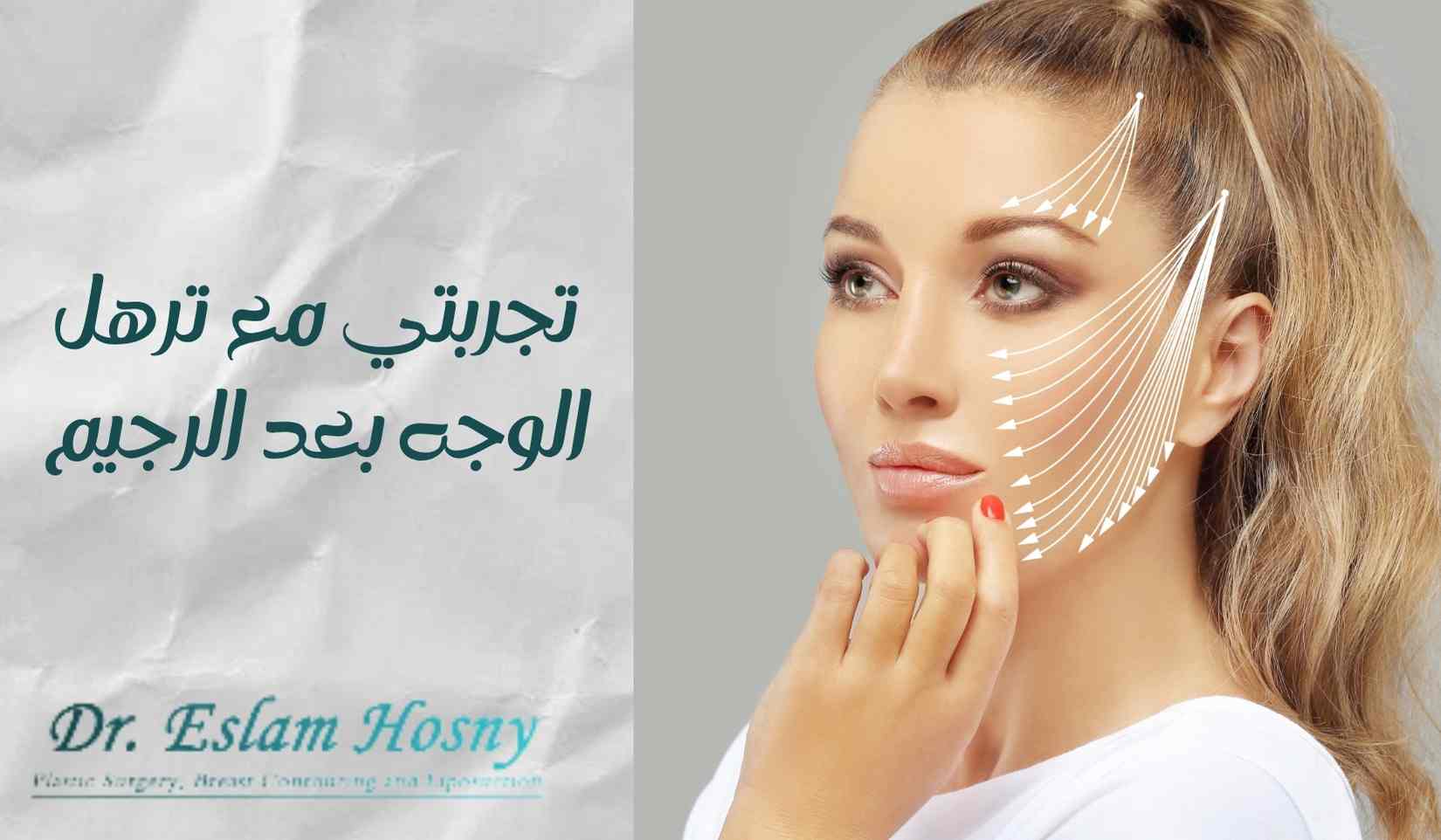 تجربتي-مع-ترهل-الوجه-بعد-الرجيم
