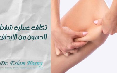 تكلفة عملية شفط الدهون من الارداف