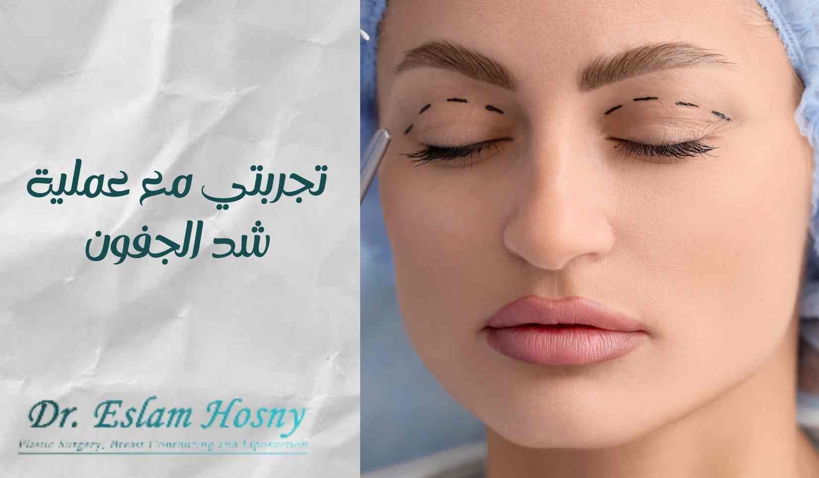 تجربتي-مع-عملية-شد-الجفون