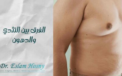 الفرق بين التثدي والدهون