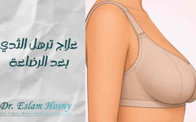 علاج ترهل الثدي بعد الرضاعة