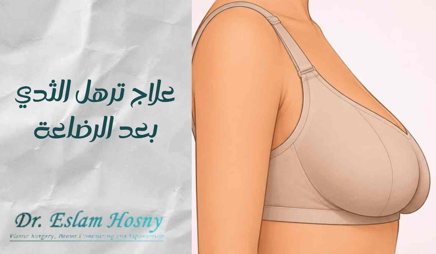 علاج-ترهل-الثدي-بعد-الرضاعة