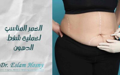 العمر المناسب لعملية شفط الدهون