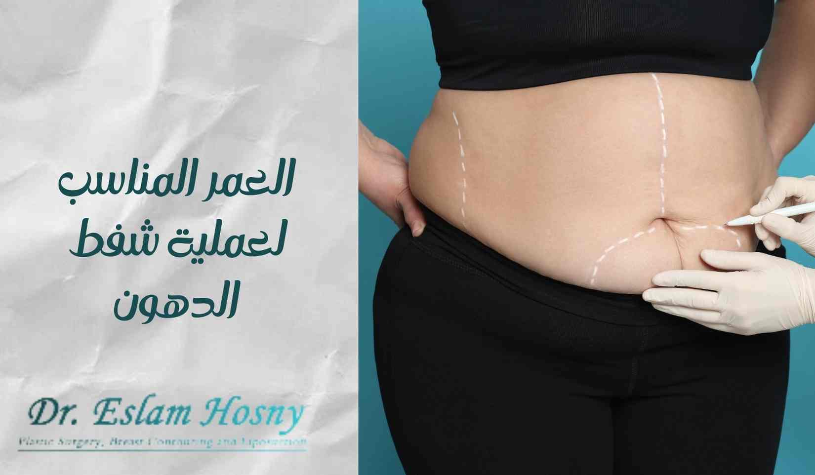 العمر-المناسب-لعملية-شفط-الدهون