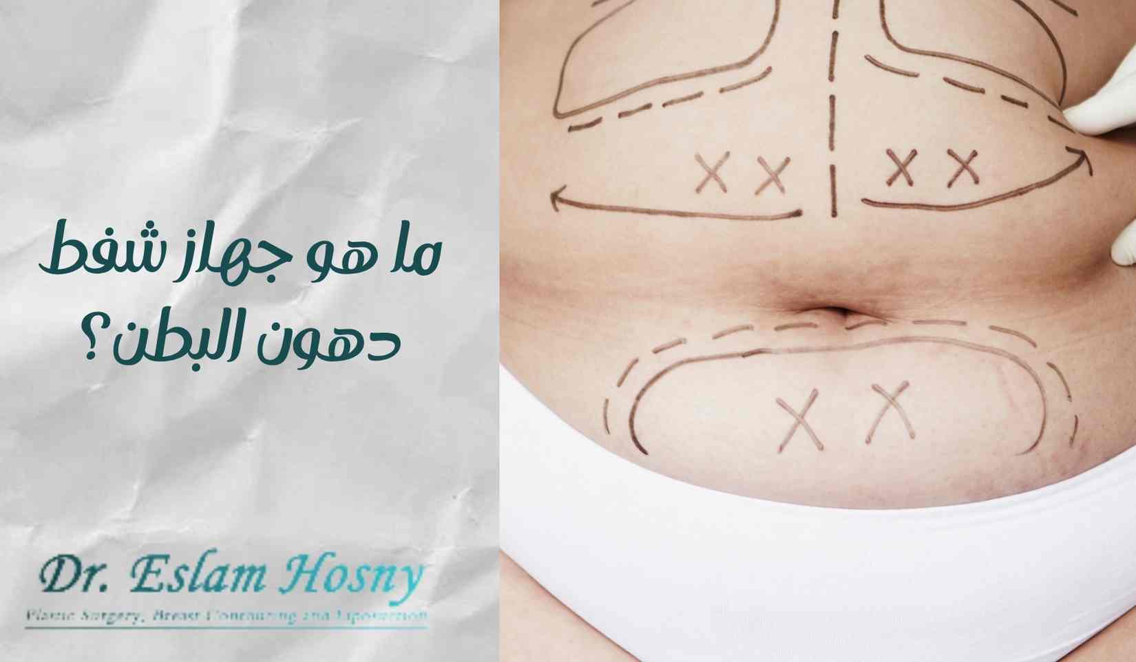 جهاز-شفط-دهون-البطن