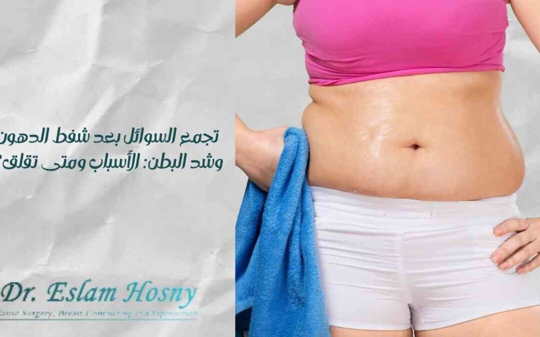 تجمع السوائل بعد شفط الدهون وشد البطن: الأسباب ومتى تقلق؟