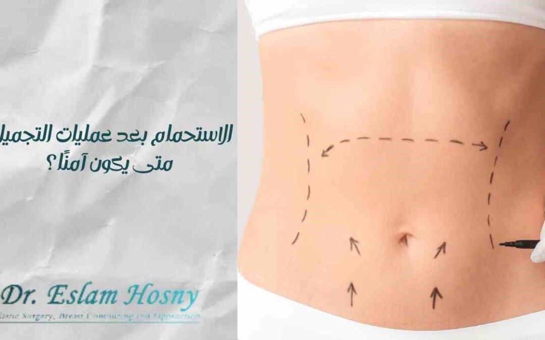 الاستحمام بعد عمليات التجميل: متى يكون آمنًا؟