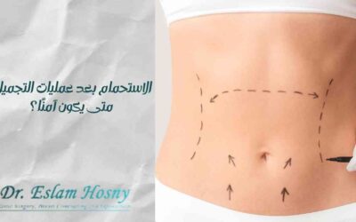 الاستحمام بعد عمليات التجميل: متى يكون آمنًا؟
