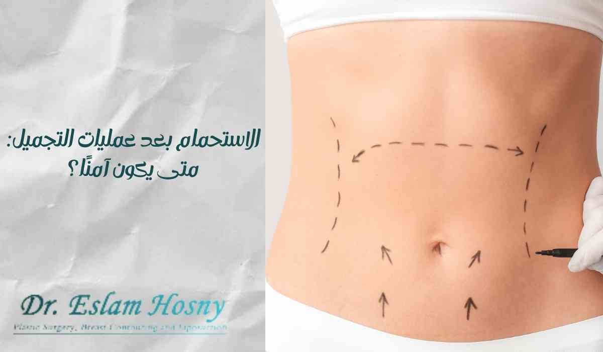 الاستحمام بعد عمليات التجميل: متى يكون آمنًا؟ الاستحمام بعد عمليات التجميل: متى يكون آمنًا؟