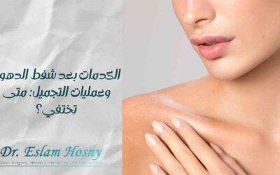الكدمات بعد شفط الدهون وعمليات التجميل: متى تختفي؟