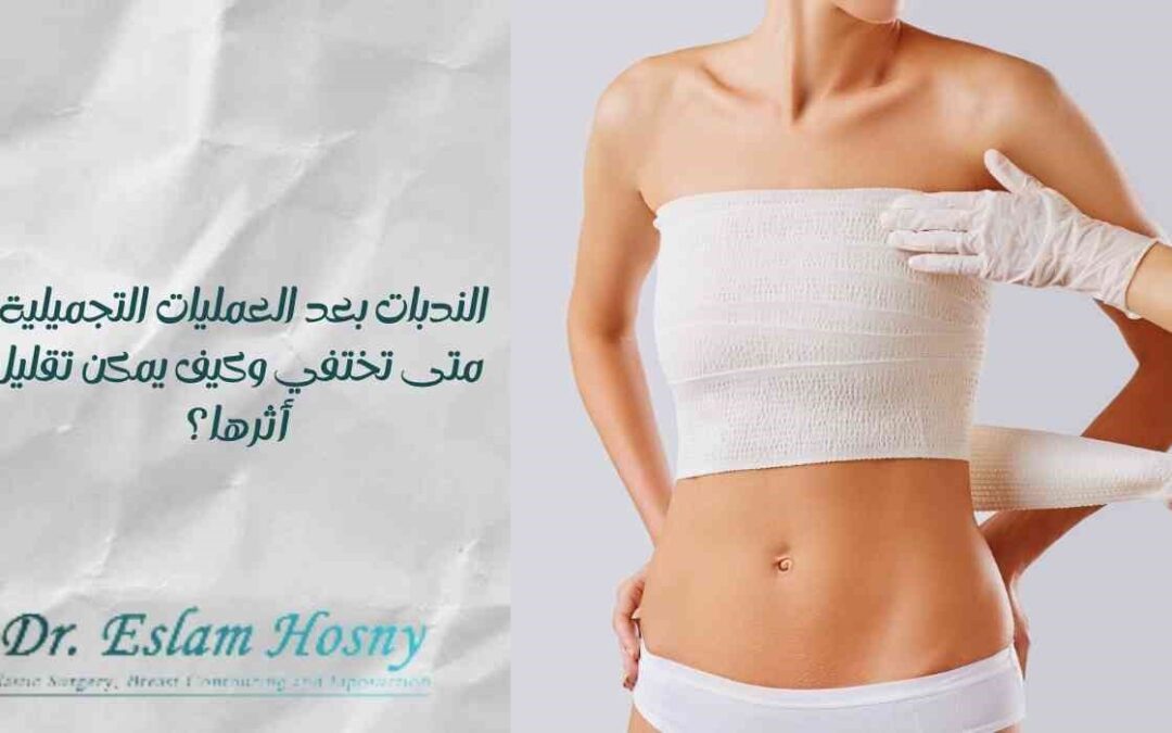 الندبات بعد العمليات التجميلية: متى تختفي وكيف يمكن تقليل أثرها؟