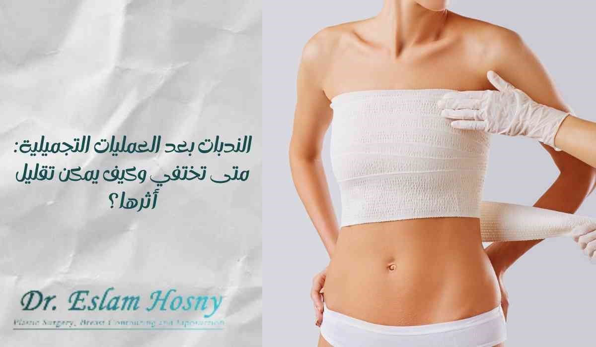 الندبات بعد العمليات التجميلية: متى تختفي وكيف يمكن تقليل أثرها؟
